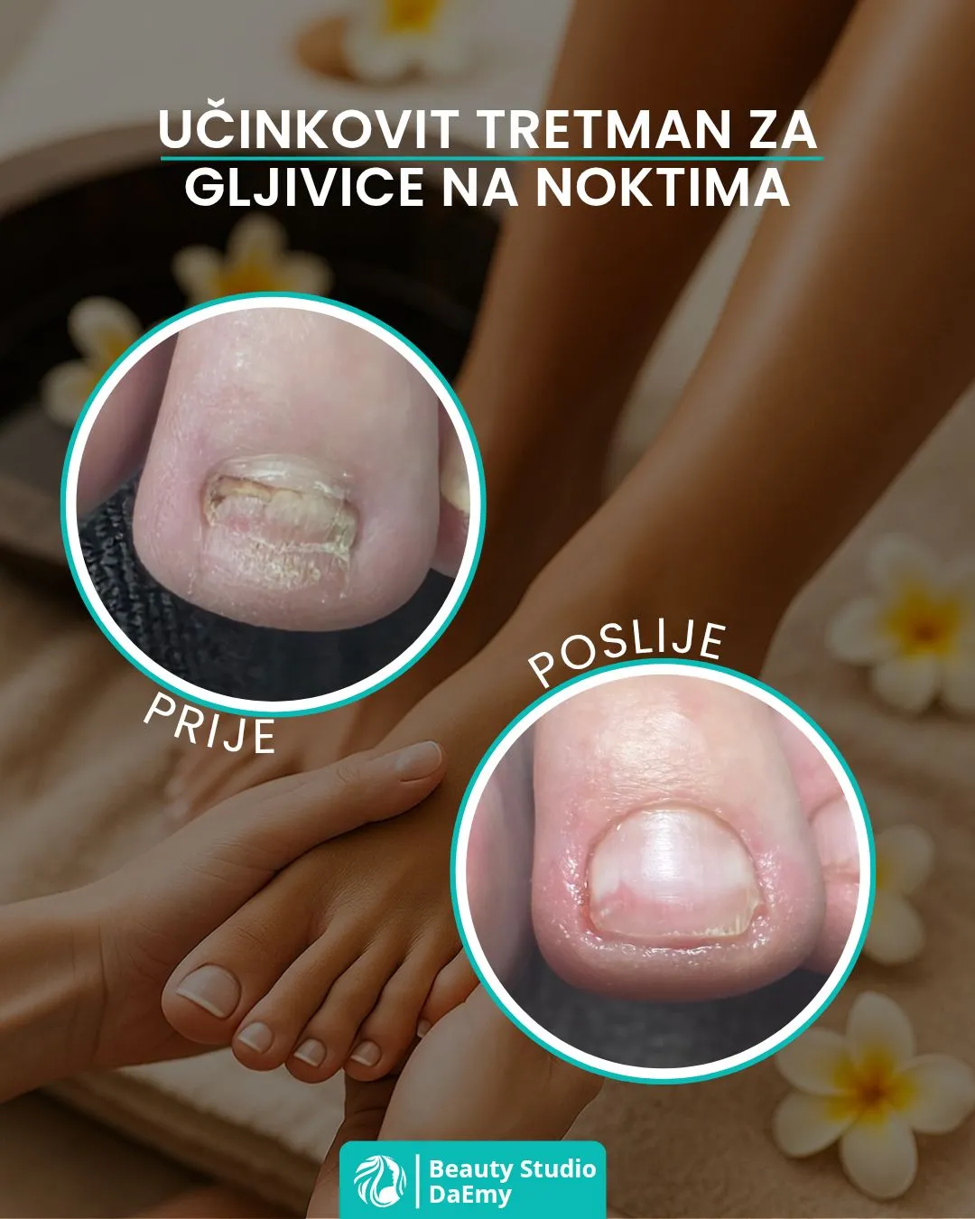 Gljivice
